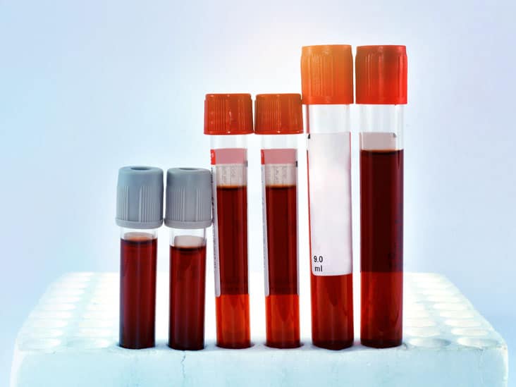 Hematokrit test Hematokrit test